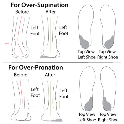 Soul Insole Heel Wedge - Reusable Adhesive Foot Alignment
